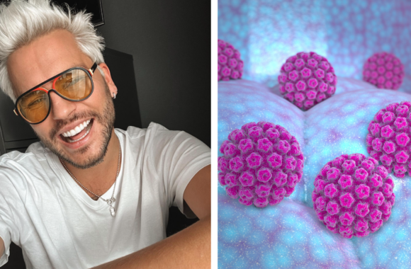 Lukas Gricius sveikata rizikuoti nenori: prevencija nuo ŽPV gali sumažinti vėžio riziką