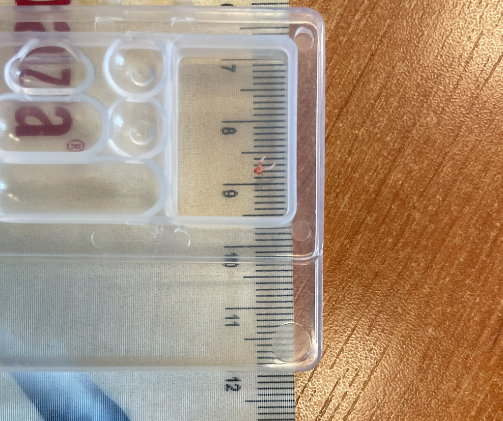 Stapedoplastikos operacijos metu pašalinta kilpelė (šalia liniuotė – matosi jos dydis)