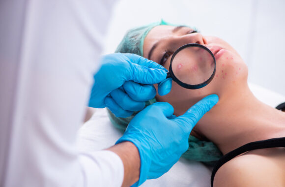 Dermatovenerologė: „Aknė jau yra netekusi tiesiog paaugliškos ligos titulo“