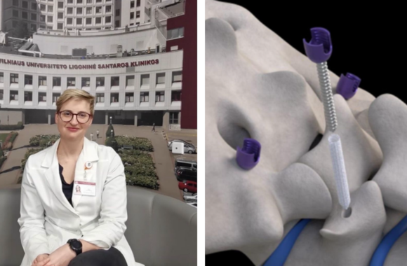 Santaros klinikose atlikta unikali operacija: neurochirurgė tai vadina „perversmu stuburo chirurgijoje“