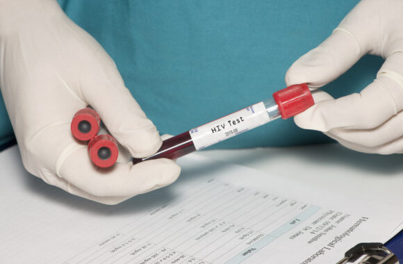 Patvirtintas ŽIV/AIDS ir lytiškai plintančių infekcijų profilaktikos bei kontrolės veiksmų planas