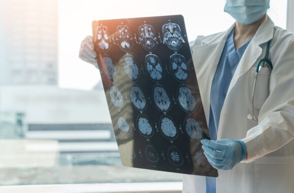 Trečdalis užsikrėtusiųjų šia liga patiria sunkų nervų sistemos pažeidimą