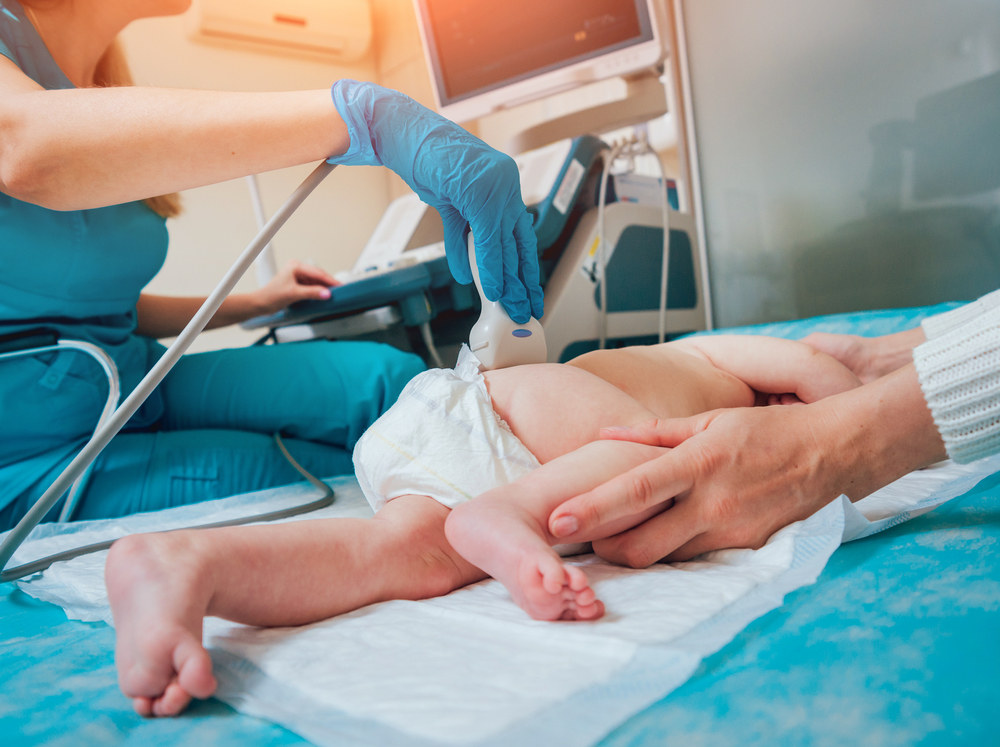 Kūdikio klubų displazija / Shutterstock nuotr.