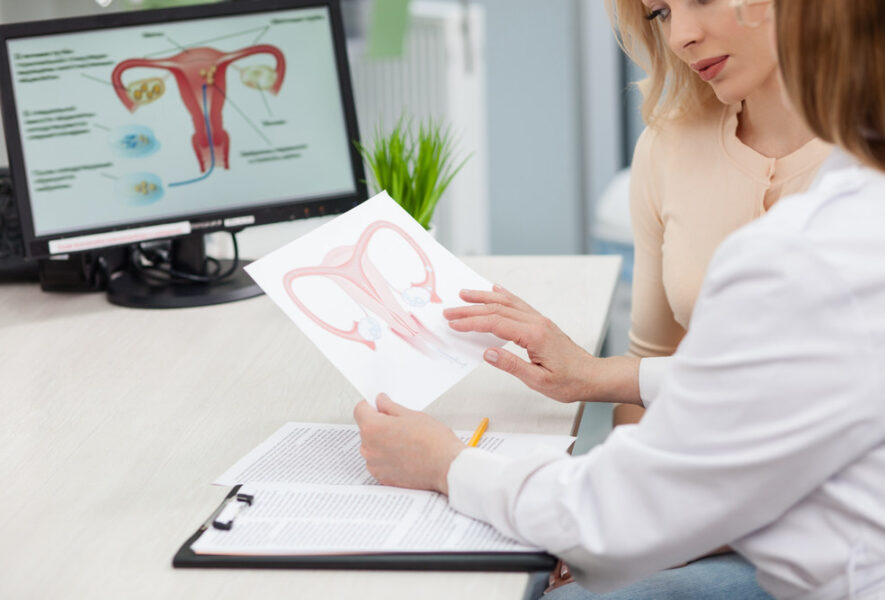 Gydytojo ginekologo konsultacija