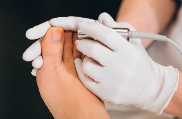 Nagų grybelis: atsiradimo priežastys ir kaip jį panaikinti?