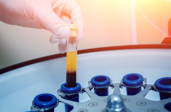 Šlapimo nelaikymas  – pagydoma liga, tik reikia išdrįsti kreiptis pagalbos