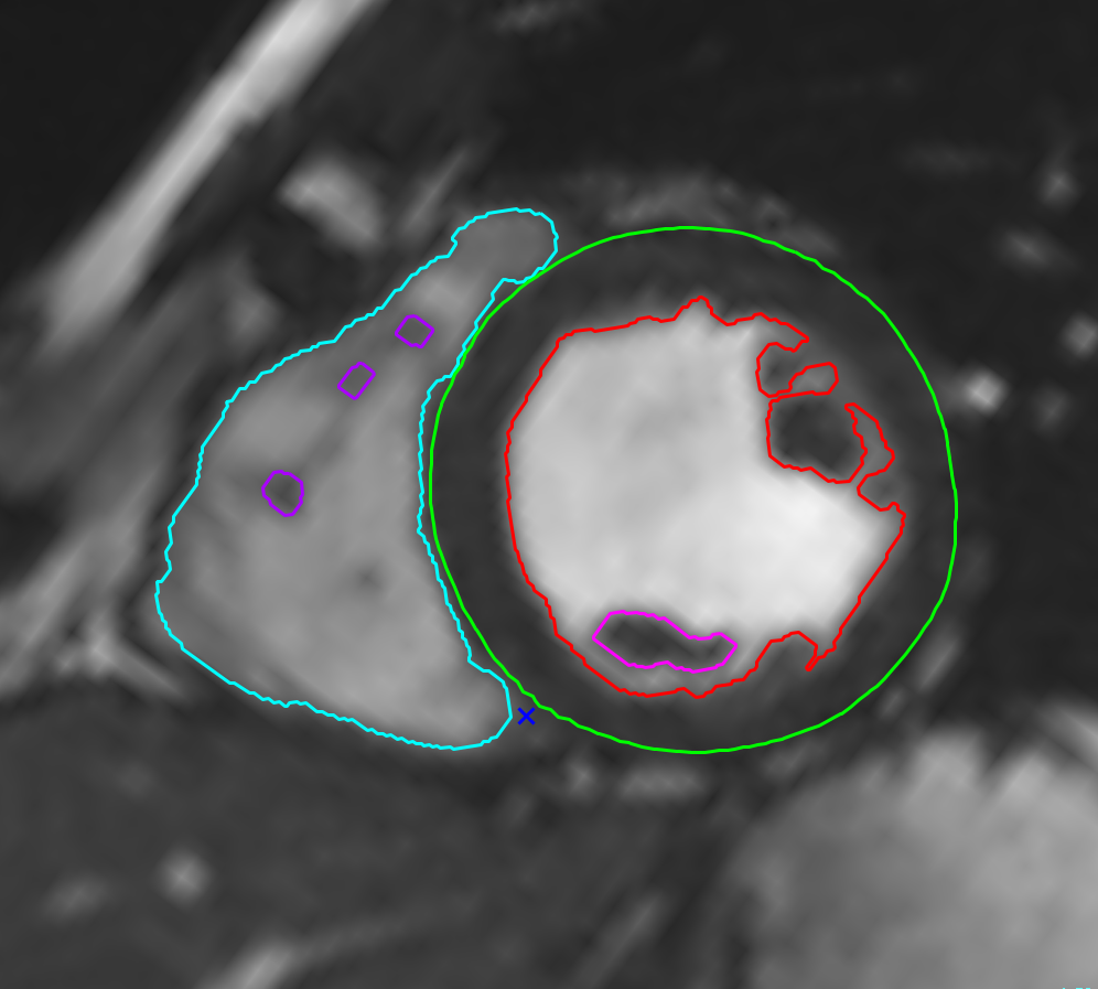 Širdies parametrinis žemėlapis (2)