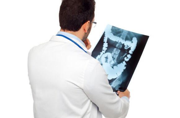 Storosios žarnos vėžio prevencinė programa