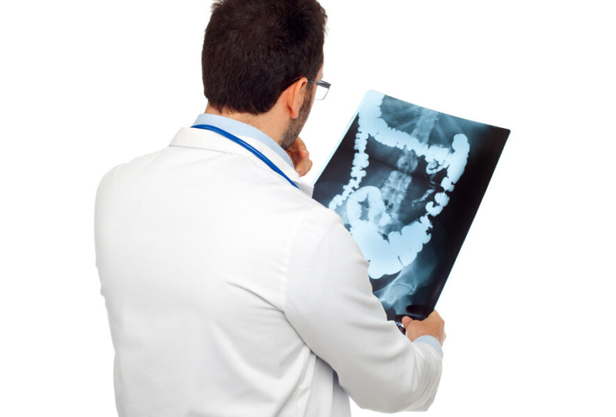 Storosios žarnos vėžio prevencinė programa