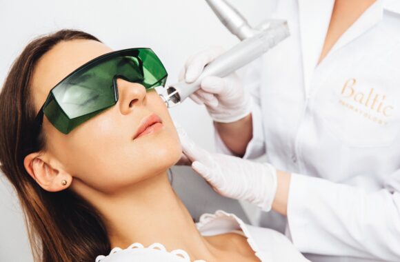 Žiemą metas pasirūpinti odos problemomis