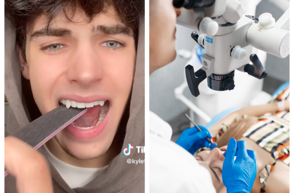 „Pats sau odontologas“: plinta pavojinga TikToko tendencija – vartotojai taisosi ir gražinasi dantis