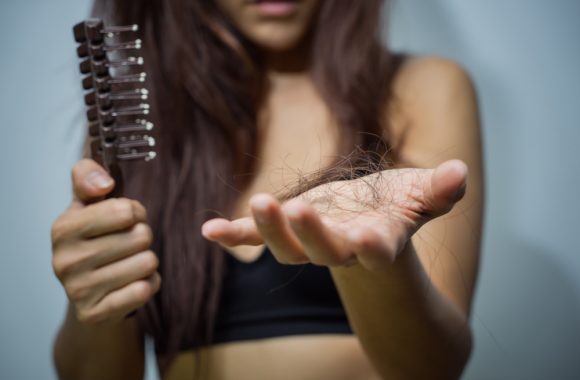 Plaukų slinkimas: gydytoja įvardino pagrindines priežastis ir gydymo būdus