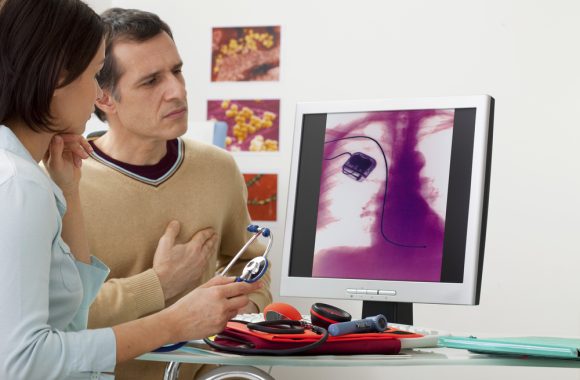 Širdies stimuliatorius