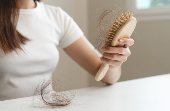 10 priežasčių, kodėl slenka plaukai