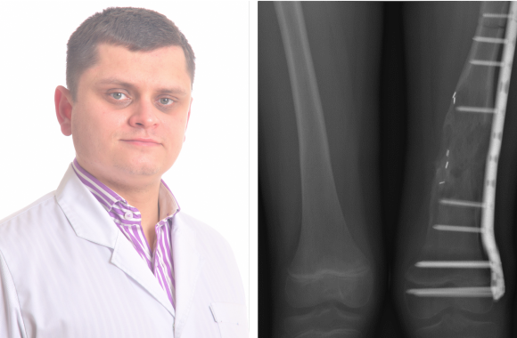 Gydytojas Rimantas Zagorskis/ Naviko operacija