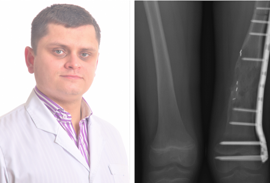 Gydytojas Rimantas Zagorskis/ Naviko operacija