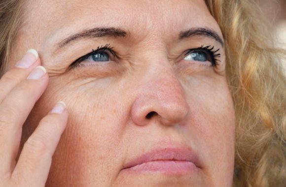 Užkritę akių vokai