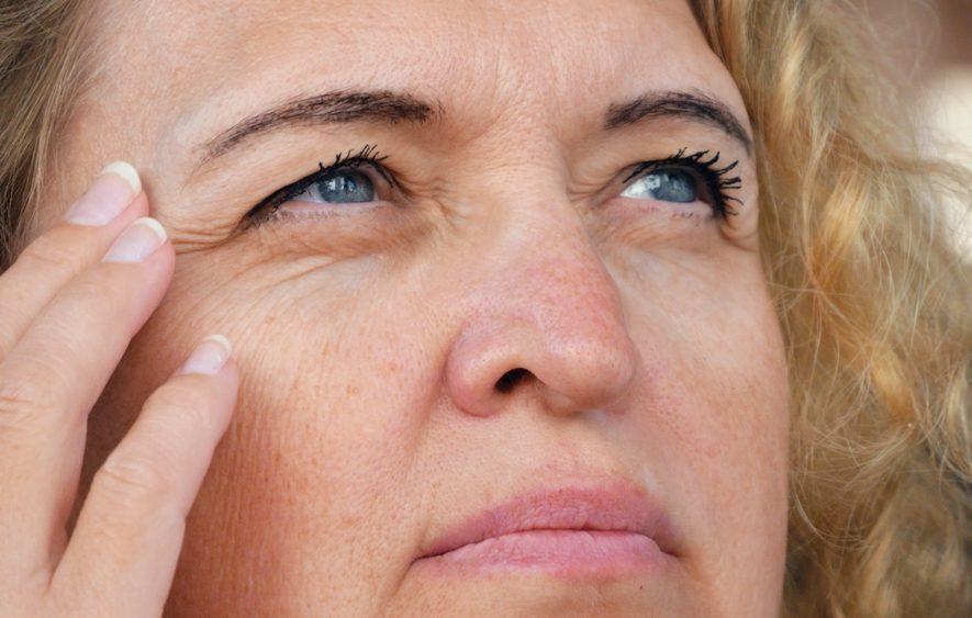 Užkritę akių vokai