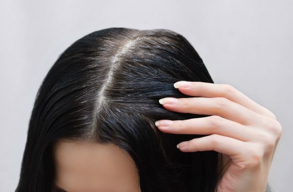 Gydytoja apie plaukus: tai vienas akivaizdžiausių amžėjimo požymių