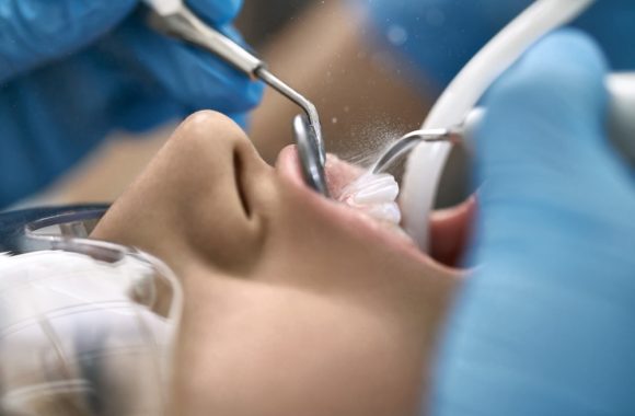 Burnos higiena: prieš ir po