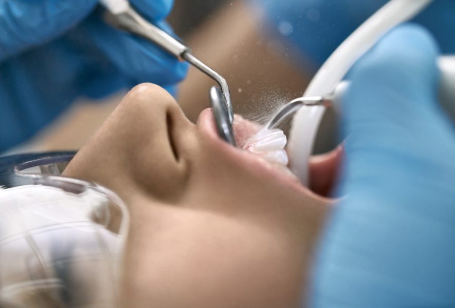 Burnos higiena: prieš ir po